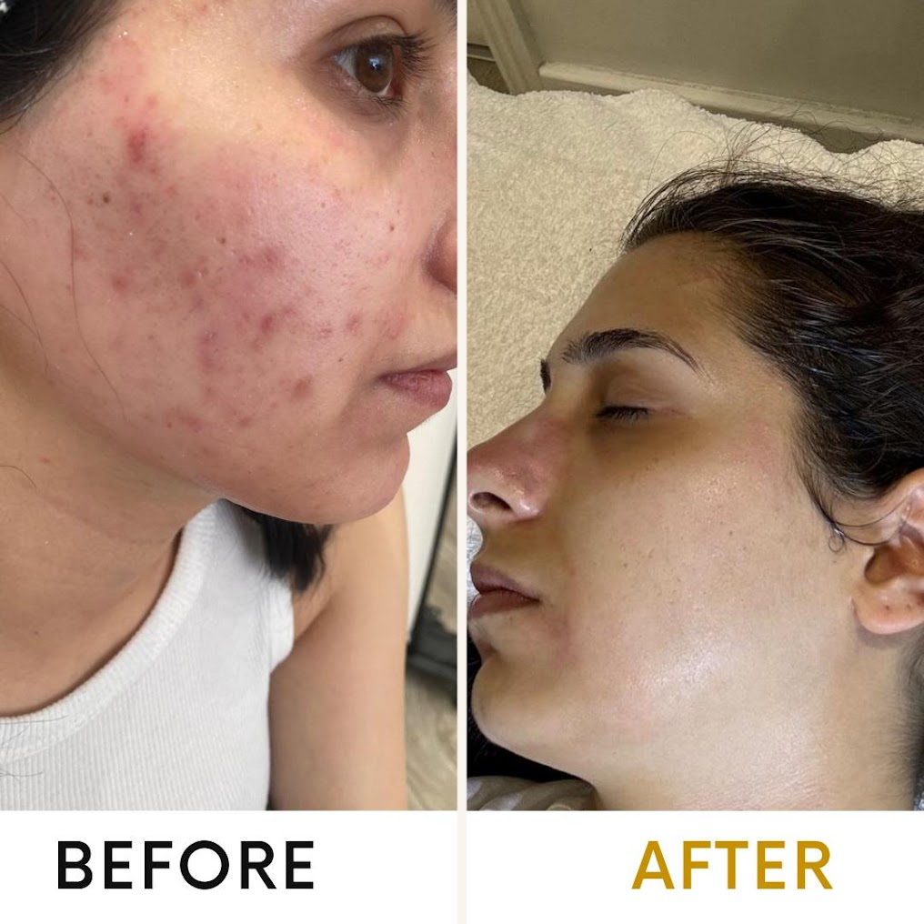 A woman after getting best facial treatments in Kentish Town