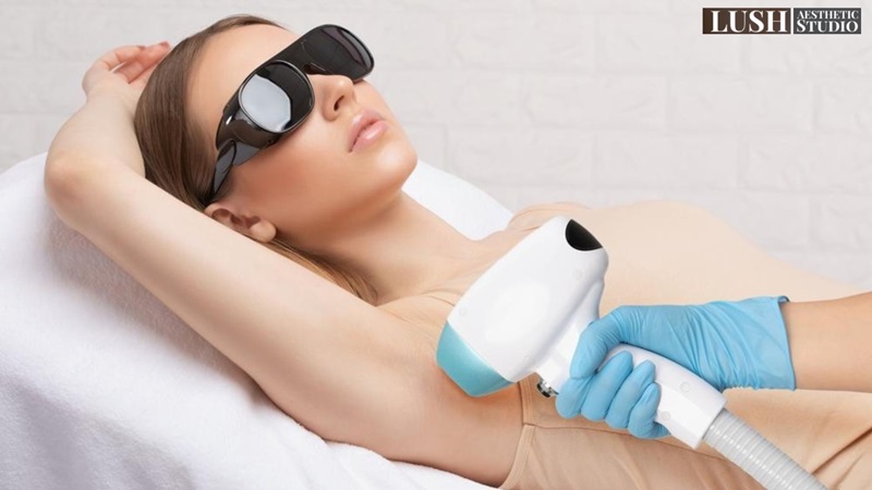 Laser hair removal in Kentish Town