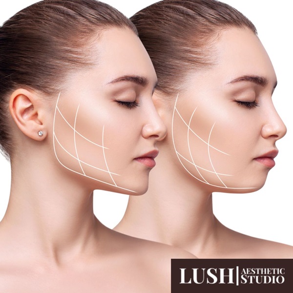 Fat Removal Injections Kentish Town