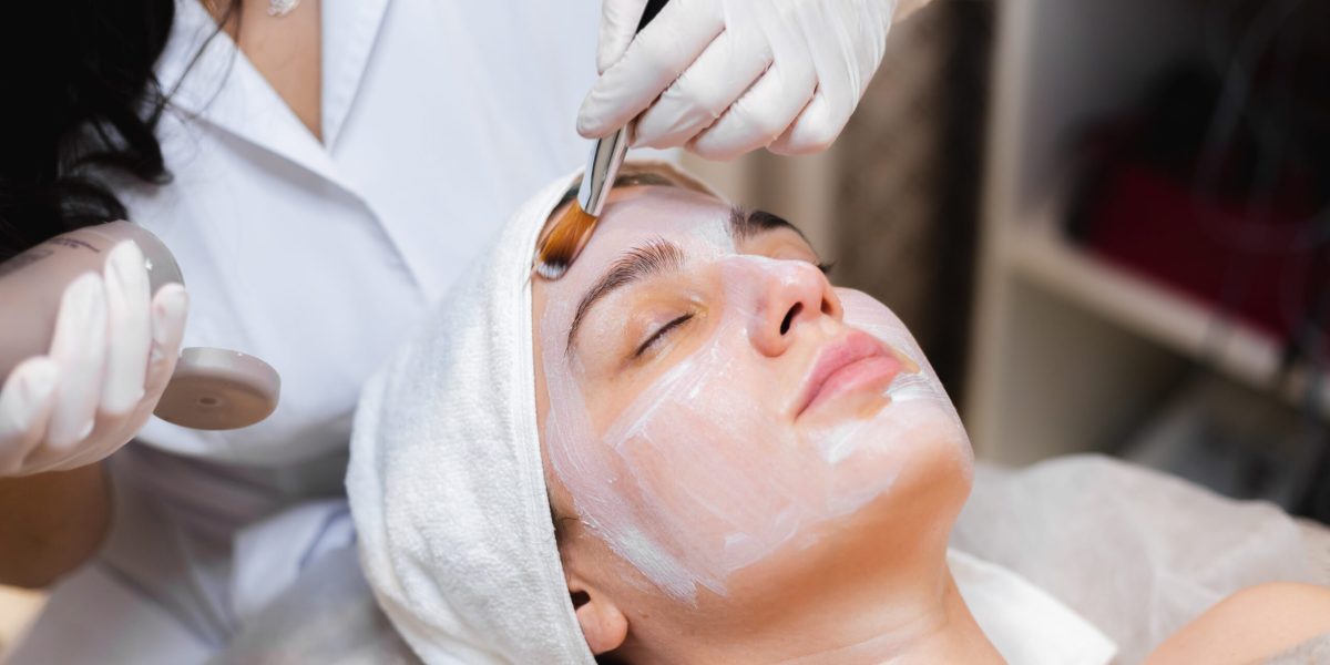 Chemical Peel in Islington