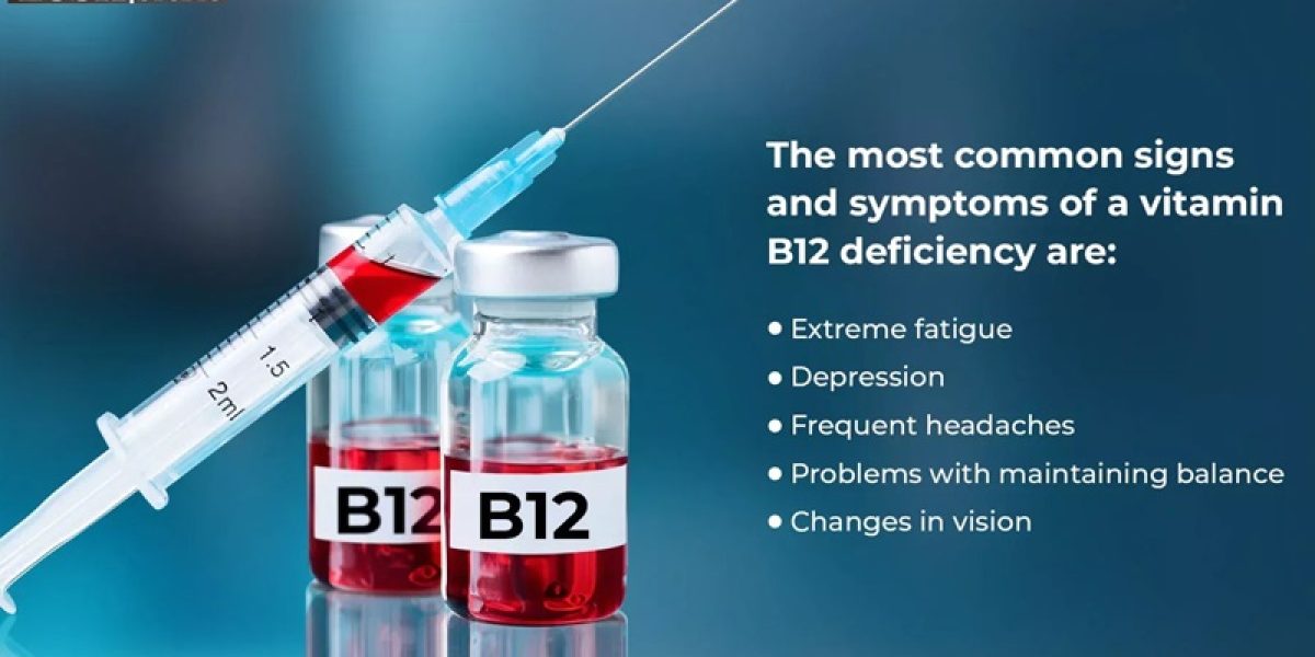 B12 shot in Kentish Town